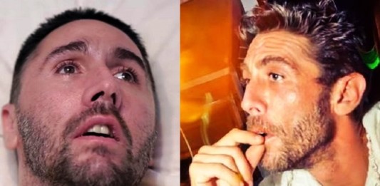fabo prima e dopo