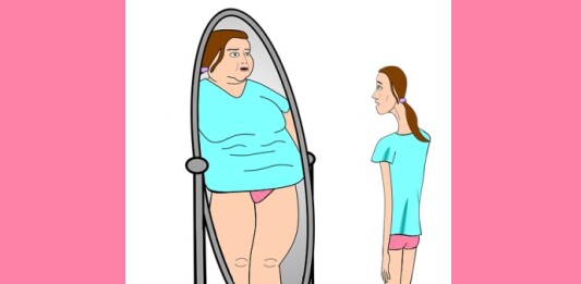 bulimia